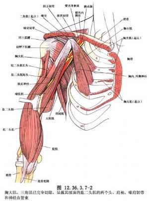胸大肌移位重建屈肘功能的手术